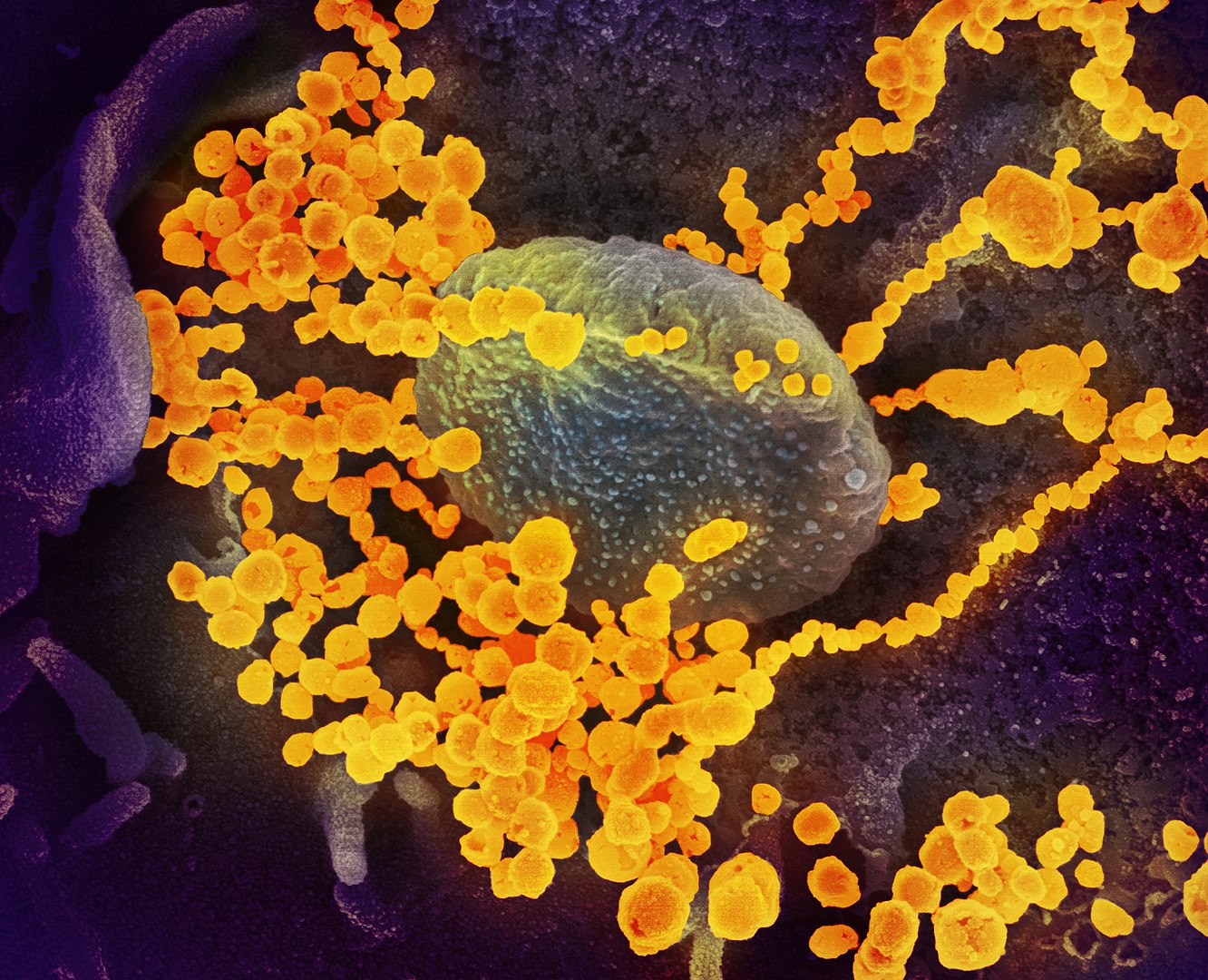 SEM image of SARS-CoV-2 (gold) emerging from the surface of cells cultured in lab by National Institute of Allergy and Infectious Diseases-https://www.flickr.com/photos/niaid/49557785797, CC BY 2.0