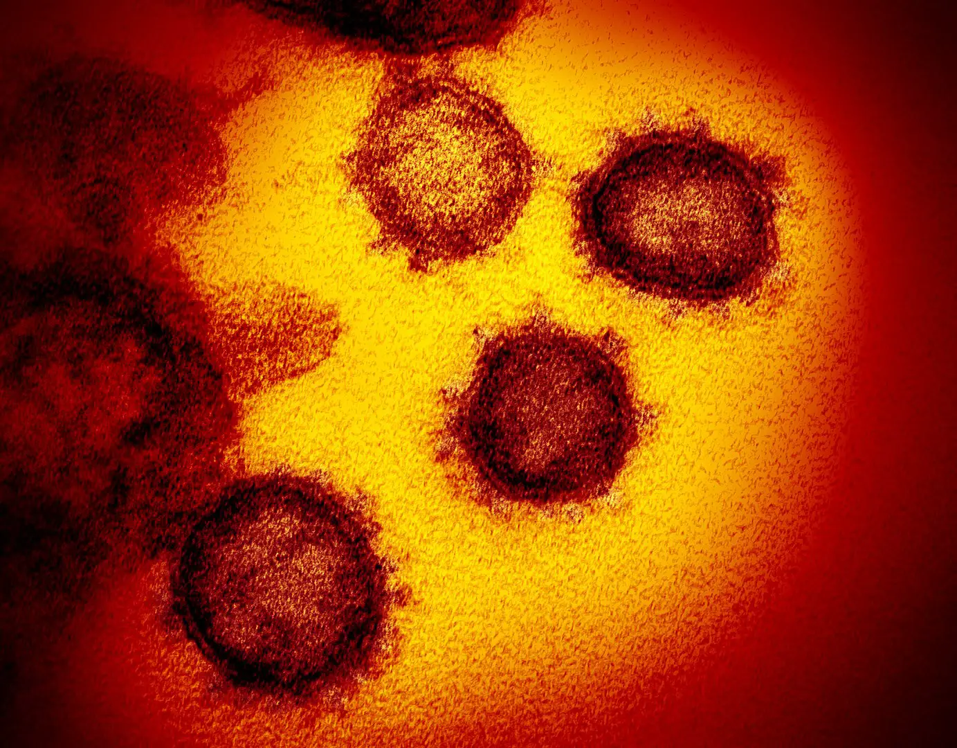 Novel Coronavirus SARS-CoV-2 TEM image, also known as the virus Covid 19 by NIAID - https://www.flickr.com/photos/niaid/49530315718, CC BY 2.0, https://commons.wikimedia.org/w/index.php?curid=87026581