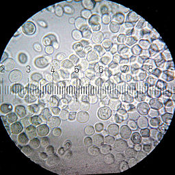 Saccharomyces cerevisiae,100× obj.15×eyepiece;numbered ticks are 1 µm apart by Bob Blaylock [CC BY-SA 3.0 (https://creativecommons.org/licenses/by-sa/3.0)]