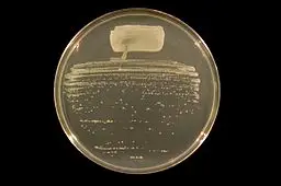 Rhizobium tropici strain BR816 streaked to single colonies on Tryptone-Yeast Extract (TY) agar:Ninjatacoshell [CC BY-SA 3.0 (https://creativecommons.org/licenses/by-sa/3.0)Wikimedia Commons