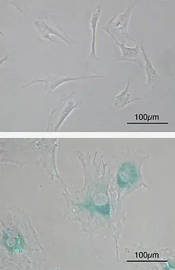 Before(upper) & after(lower) senescence, microscopic image of mouse embryonic fibroblast cells(SABG assay. 100X magnification.) by Y tambe/CC BY-SA (http://creativecommons.org/licenses/by-sa/3.0/)