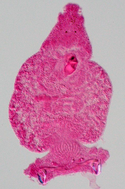 Pseudorhabdosynochus morrhua Justine, 2008 (Monogenea, Diplectanidae) by Jean-Lou Justine - Own work, CC BY-SA3.0,https://commons.wikimedia.org/w/index.php?curid=18388378