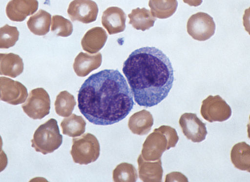 Monocytes by Dr Graham Beards (Own work) [CC BY-SA 3.0 (https://creativecommons.org/licenses/by-sa/3.0)], via Wikimedia Commons
