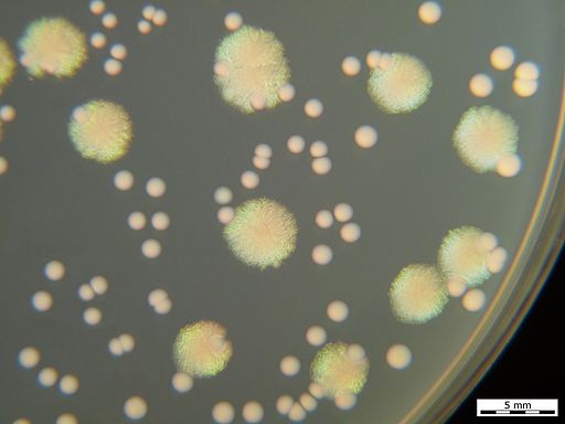 Pseudomonas aeruginosa and Enterococcus faecalis onTryptic Soy Agar. Cultivation 24 hours, 37°C by HansN. / CC BY-SA (https://creativecommons.org/licenses/by-sa/3.0)