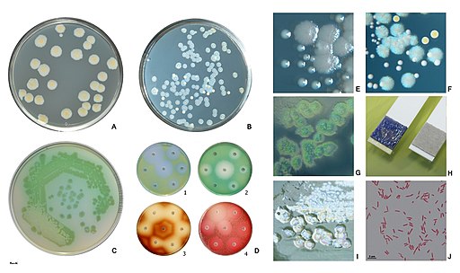 Pseudomonas aeruginosa pigment production, cetrimide agar, oxidase test, plague formation & Gram stain by HansN., CC BY-SA 4.0 <https://creativecommons.org/licenses/by-sa/4.0>, via Wikimedia Commons