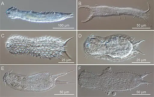 Class Gastrotricha by M. Antonio Todaro, Matteo Dal Zotto, Sarah J. Bownes, Renzo Perissinotto, CC BY 3.0 <https://creativecommons.org/licenses/by/3.0>, via Wikimedia Commons