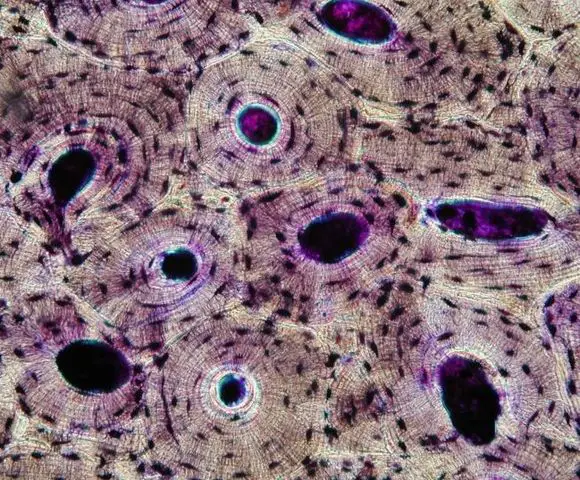 Bone Tissue And Cells Under The Microscope