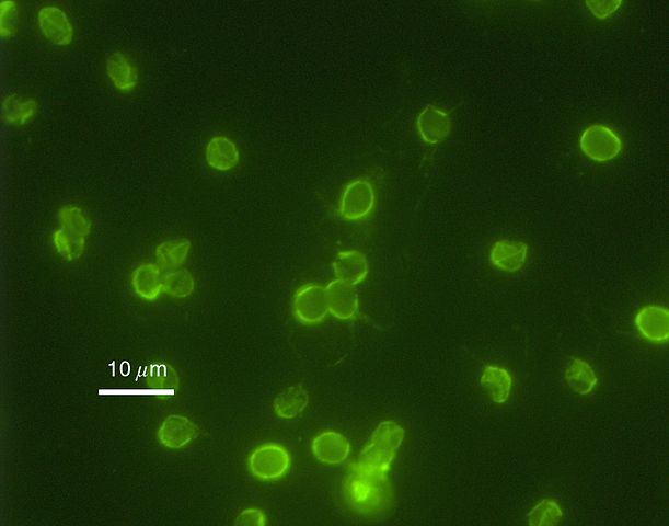 Image under Immunofluorescence of Cyclosporidium Parvum, Public Domain,  https://commons.wikimedia.org/w/index.php?curid=2740699