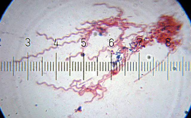 Sebészet | Digitális Tankönyvtár - Sápadt spirochete paraziták A spirochete parazita
