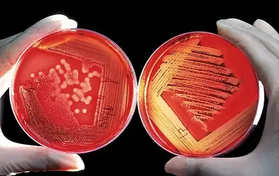 Blood agar plates are often used to diagnose infection. On the right is a positive Streptococcus culture; on the left is a positive Staphylococcus culture.