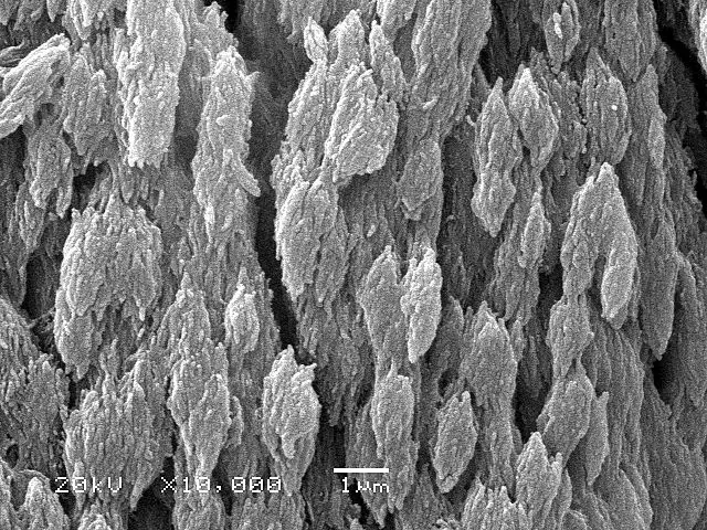 Deproteined wistar rat bone SEM micrography 10000 magnificationBy User:Sbertazzo - English wikipedia, Public Domain, https://commons.wikimedia.org/w/index.php?curid=12404244