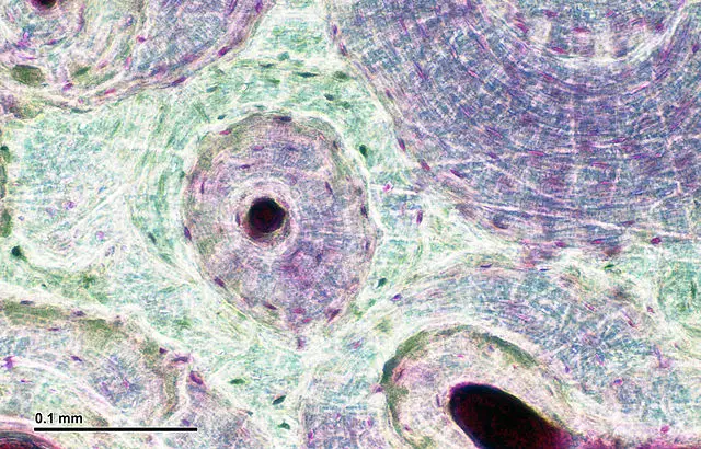 Bone Tissue and Cells Under The Microscope