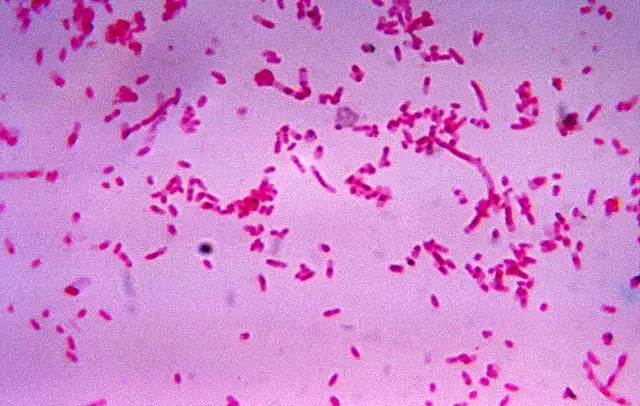 Fusobacteria by Dr.V.R.Dowell - CDC.gov, Public Domain, https://commons.wikimedia.org/w/index.php?curid=1861316