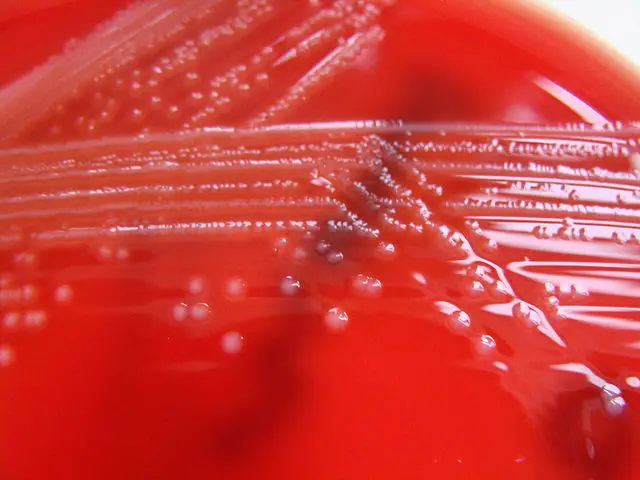 Listeria monocytogenes - Columbia Horse Blood Agar by Nathan Reading, https://www.flickr.com/photos/nathanreading/6268795918/, CC BY 2.0, https://commons.wikimedia.org/w/index.php?curid=18977688
