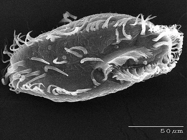 Scanning electron microscope view of Oxytricha trifallaxby Unknown author - [1], Public Domain, https://commons.wikimedia.org/w/index.php?curid=5684090