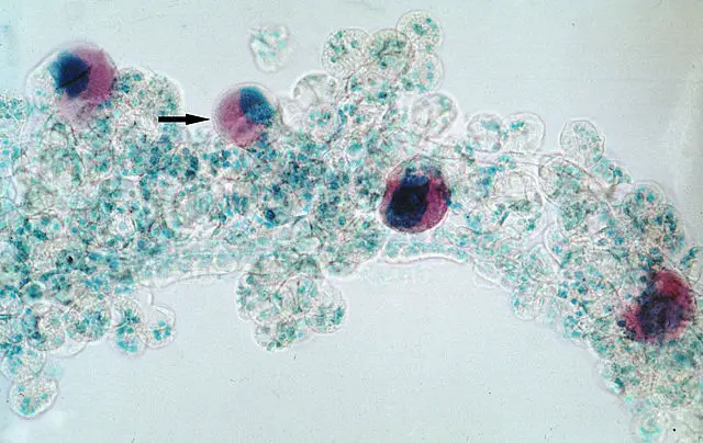 Salivary gland of Hyalomma a.anatolicum infected with sporoblast stage of Theileria annulata protozoa by Alan R Walker, own work, CC BY-SA 3.0,https://commons.wikimedia.org/w/index.phpcurid=19034550