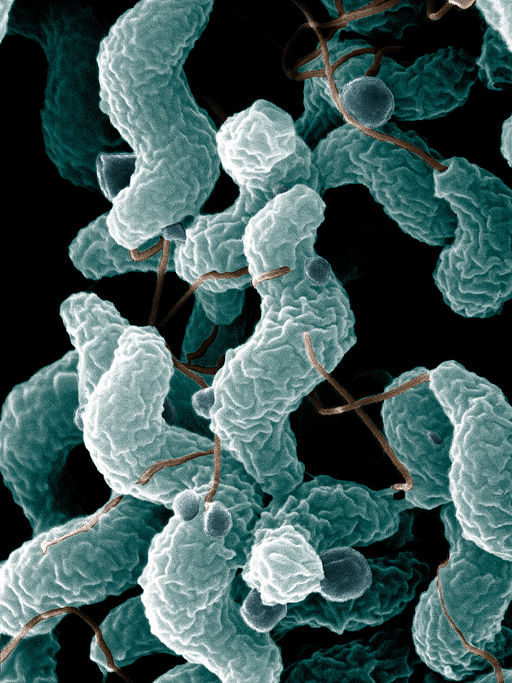 Campylobacter bacteria are the number-one cause of bacterial food-related gastrointestinal illness. Credit: De Wood, Pooley, USDA, ARS, EMU., Public domain, via Wikimedia Commons