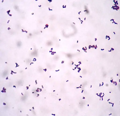 Gram stain of Actinobaculum shaalii of phylum Actinobacteria by Manurx27, CC BY-SA 4.0 <https://creativecommons.org/licenses/by-sa/4.0>, via Wikimedia Commons