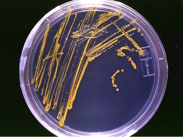 agar plate with bacteria