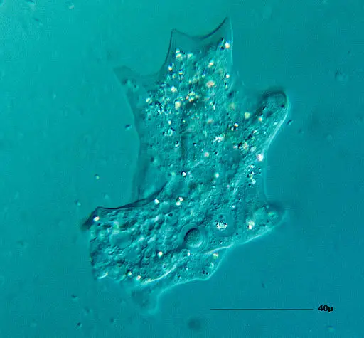 Amoeba by Picturepest [CC BY 2.0 (https://creativecommons.org/licenses/by/2.0)]