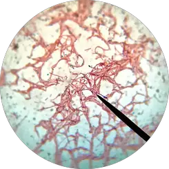 Endospore Stain Definition Techniques Procedures And Significance
