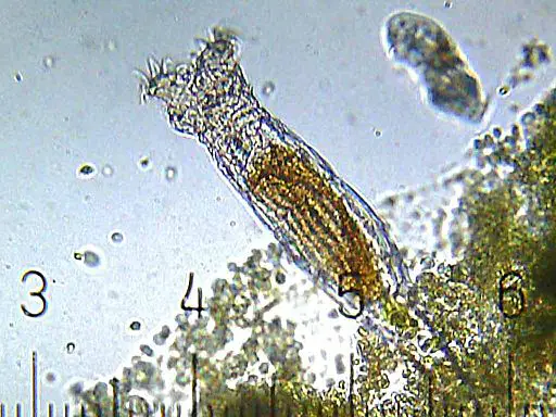 bdelloid rotifer image - aschelminthes page