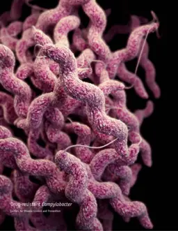 Campylobacter: CDC [Public domain], via Wikimedia Commons, Source: https://phil.cdc.gov/Details.aspx?pid=16870