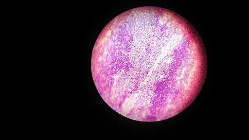 Escherichia coli under 10х90х magnification using fuchsine as a dye By ElNokko (Own work) [CC BY-SA 4.0 (http://creativecommons.org/licenses/by-sa/4.0)], via Wikimedia Commons