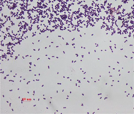 Gram stain for Enterococcus faecalis under 1000 magnification (bright field microscopy). Dr. Sahay, CC BY-SA 3.0 <https://creativecommons.org/licenses/by-sa/3.0>, via Wikimedia Commons