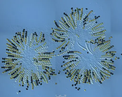 Linear arrangement of ascospores in the asci of the fungus by Aurora Storlazzi [CC BY 4.0 (https://creativecommons.org/licenses/by/4.0)], from Wikimedia Commons
