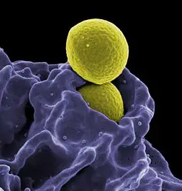 MRSA ingested by Neutrophil by National Institutes of Health (NIH) [Public domain]