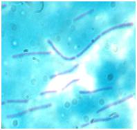 yogurt Lactobacillus under microscope