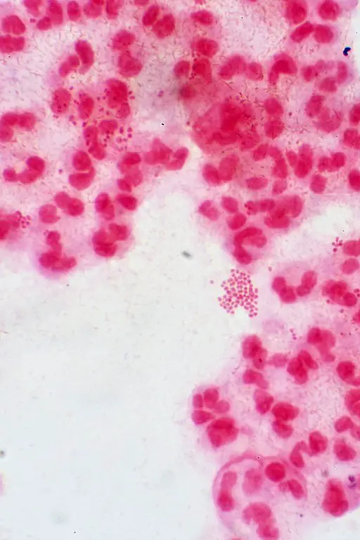 Neisseria gonorrhoeae with pus cells, Gram-stain by Dr Graham Beards, CC BY-SA 4.0 <https://creativecommons.org/licenses/by-sa/4.0>, via Wikimedia Commons