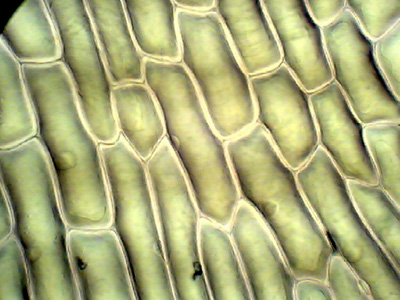 onion epidermal cells under microscope