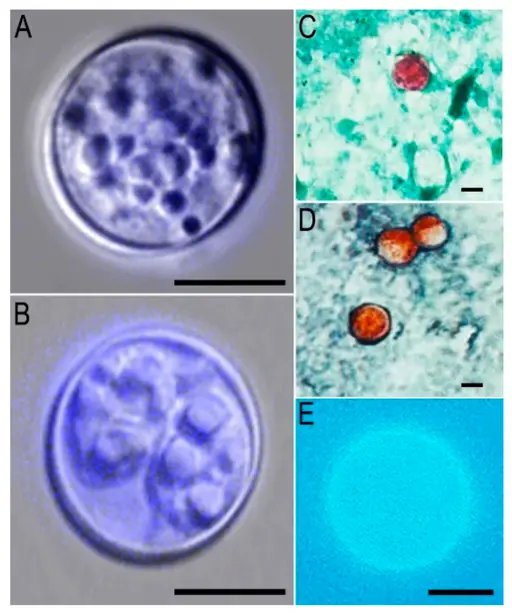 Cyclospora oocysts by Sonia Almeria, Hediye N. Cinar and Jitender P. Dubey / CC BY (https://creativecommons.org/licenses/by/1.0)