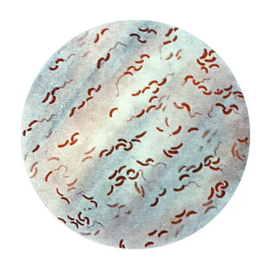Cholera Vibrio cholerae, Photo by USCDCP, Usage: public domain (CC0)