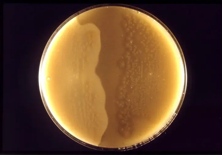Cultured Clostridium Perfringens by Author: Dr. Stuart E. Starr, USCDCP at Pixnio.com unaltered