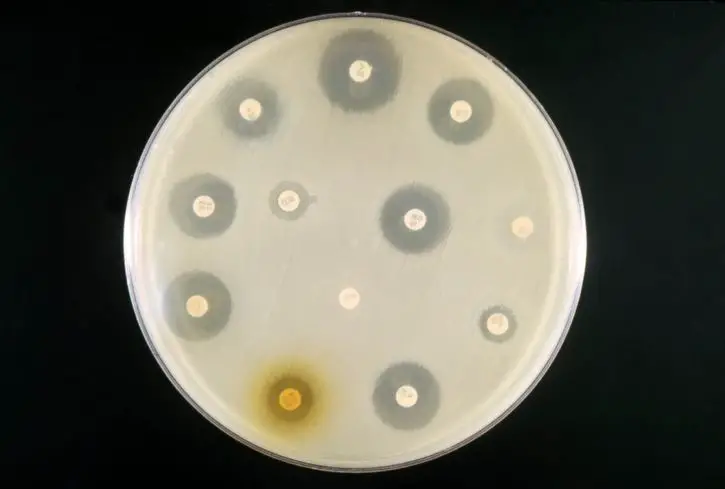 Sensitivity test of Escherichia coli by USCDCP on Pixnio,Usage: public domain (CC0)