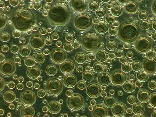 Various phosphatidylcholine liposomes in suspension. Method of phase contrast microscopy (1000-fold magnification) by ArkhipovSergey / CC BY-SA (https://creativecommons.org/licenses/by-sa/4.0)