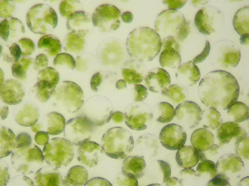 Protoplast Solution, Cells of Petunia leaves By Mnolf (Own work) [CC BY-SA 3.0 (http://creativecommons.org/licenses/by-sa/3.0)