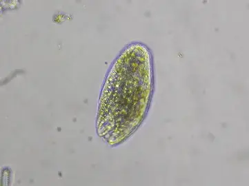 Protozoan és metazoan paraziták. Mi a cystitis protozoa?