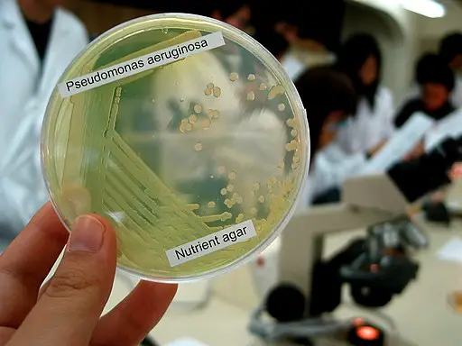 Bacteria Pseudomonas Aeruginosa on a lab plate, culture media by Denise Chan / CC BY-SA (https://creativecommons.org/licenses/by-sa/2.0)