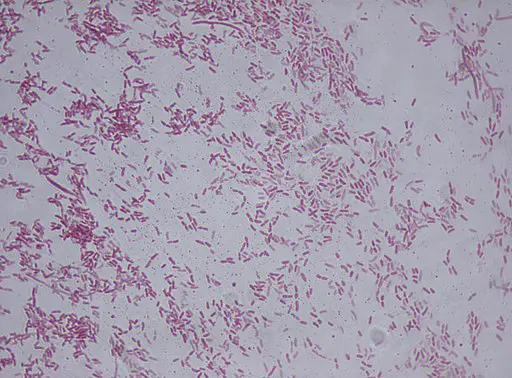 Pseudomonas fluorescens gram stain by Riraq25, CC BY-SA 3.0 <https://creativecommons.org/licenses/by-sa/3.0>, via Wikimedia Commons
