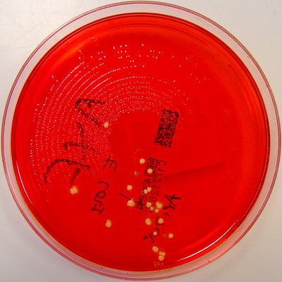 Shigella species on X.L.D. Agar by Nathan Reading on Flickr.com. No changes made. CCO.