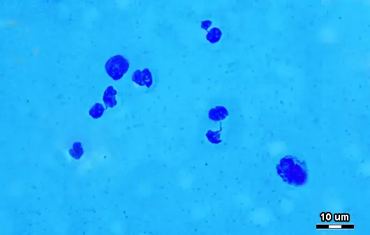 Dark blue colored somatic cells on a light blue background by PeterNR, CC BY-SA 4.0 <https://creativecommons.org/licenses/by-sa/4.0>, via Wikimedia Commons