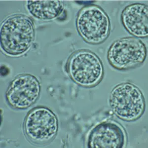 T. gondii oocysts in fecal flotation -US Center for Disease Control & Prevention,http://dpd.cdc.gov/dpdx/HTML/ImageLibrary/Toxoplasmosis_il.htm,https://commons.wikimedia.org/w/index.php?curid=25110770