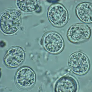 Toxoplasma spóra. Petesejtek és paraziták jelei és tünetei
