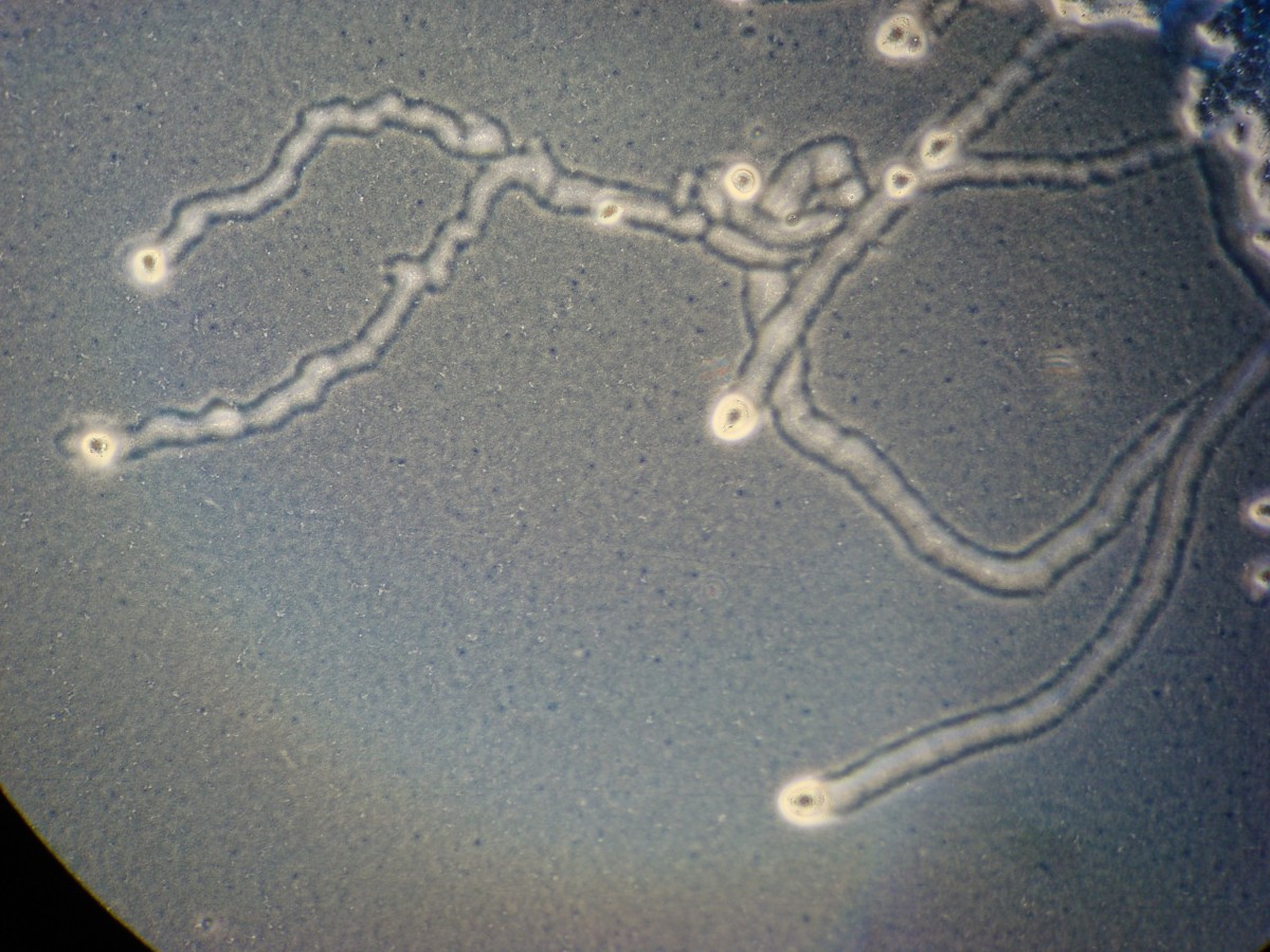 A. castellanii (ATCC ® 30010) feeding tracks on Non-Nutrient Agar E. coli p...