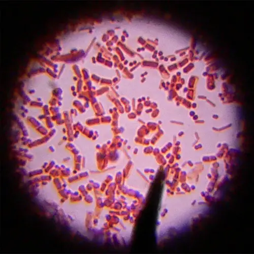 Bacteria, Bacilli and Cocci, colored with the Gram staining. Magnification: 1000x ( with immersion oil) by Umberto Salvagnin on Flickr.com. https://creativecommons.org/licenses/by/2.0/