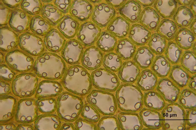 Bazzania Tricrenata cells  Image by WikimediaImages from Pixabay.